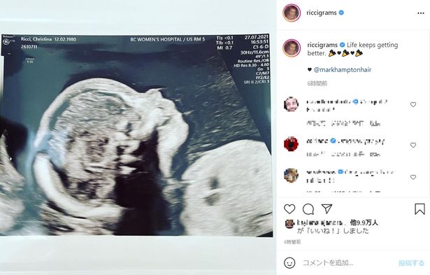 先日、Instagramにエコー写真を掲載し妊娠を明らかにしたクリスティーナ・リッチ