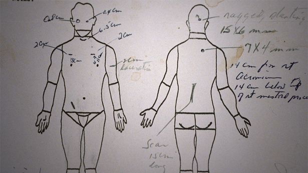 どの方向から狙撃を受けたのか…検死記録のメモも破棄され、不可解な点が多い